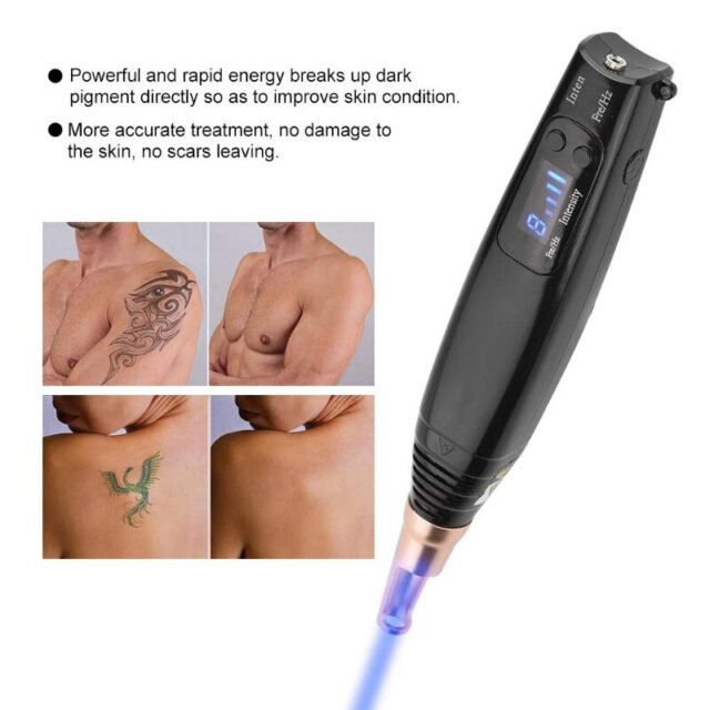 Pikosekunden-Laserstift zur Entfernung von Flecken und Sommersprossen – Bild 4